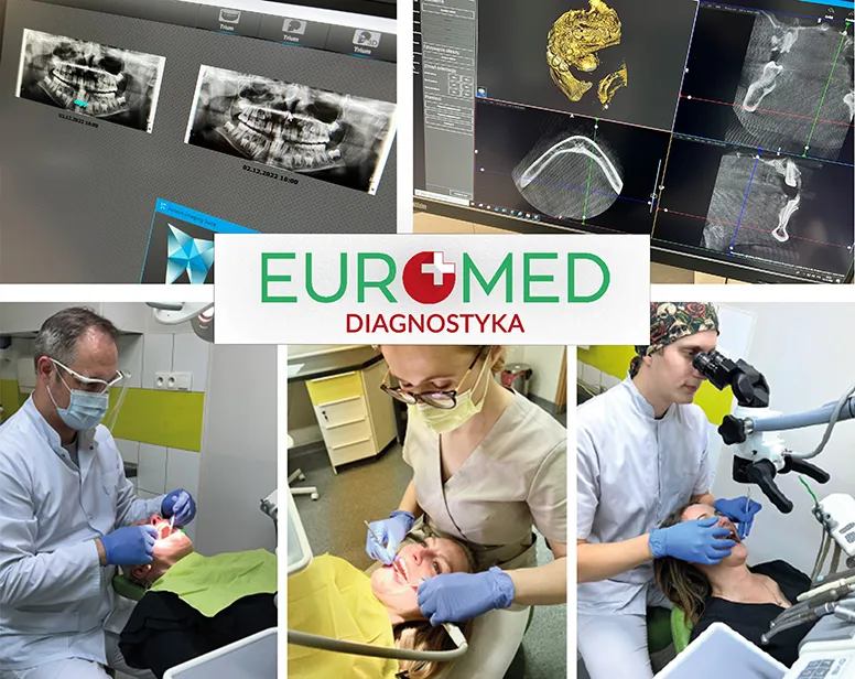 Precyzyjna diagnostyka w endodoncji